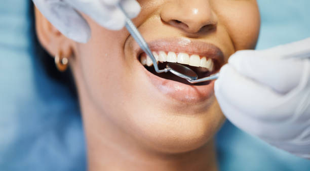 Best Broken or Chipped Tooth Repair in Lake Carmel, NY